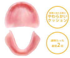 柔らかい総入れ歯reva